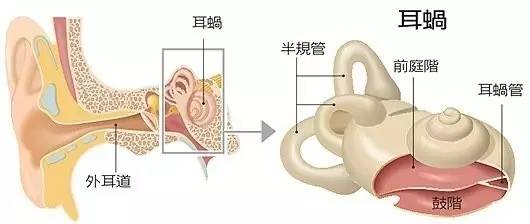 全植入式人工耳蜗是否有可能?3种设计理念并驾齐驱